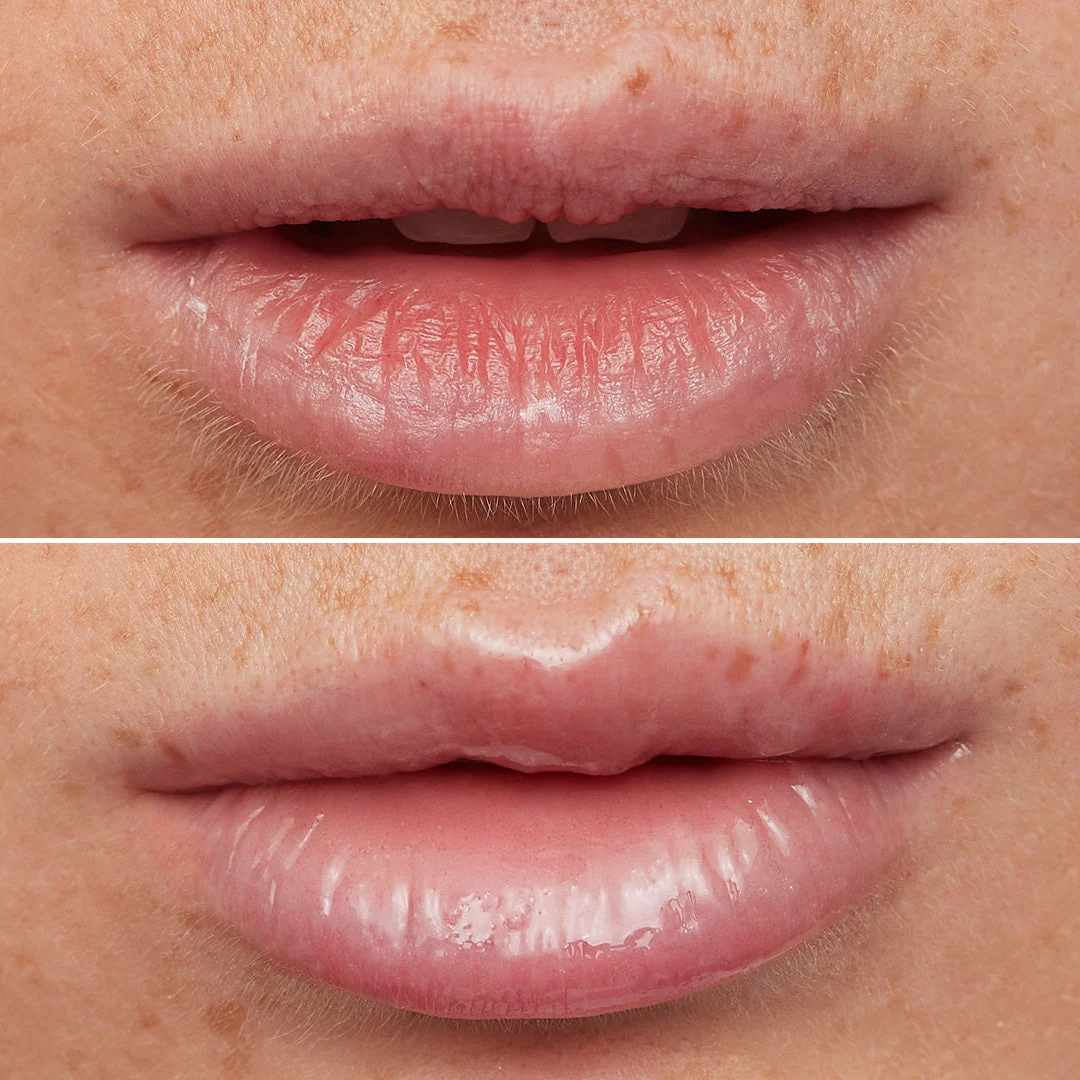 Lip Rehab Serum Oil - Image 10
